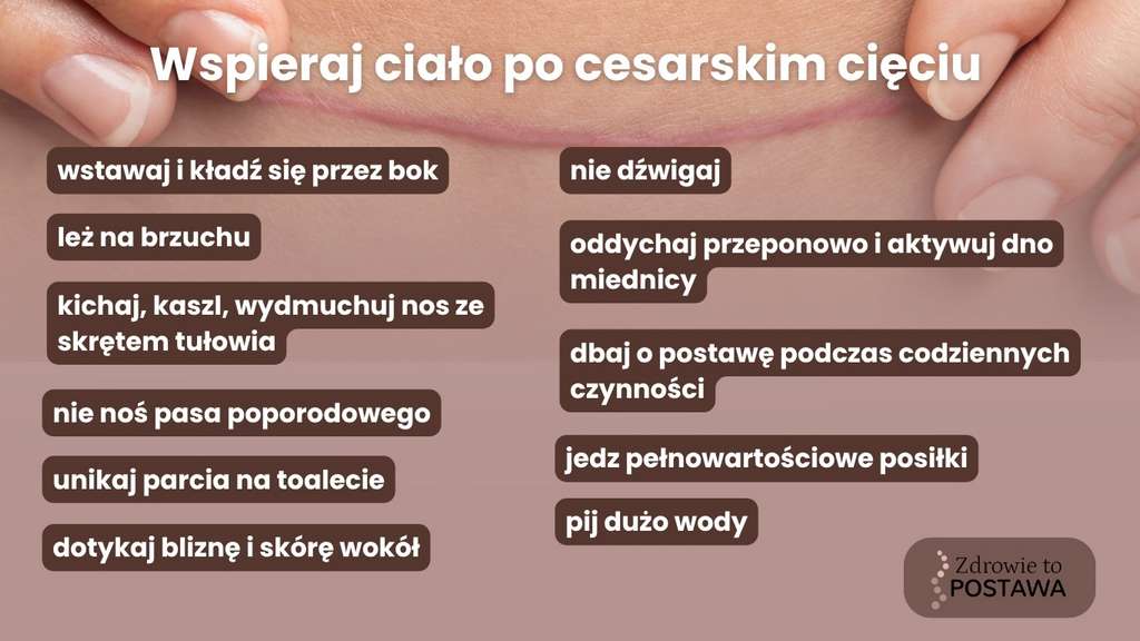 Cesarskie cięcie co musisz wiedzieć? Fizjoterapia uroginekologiczna Komorniki