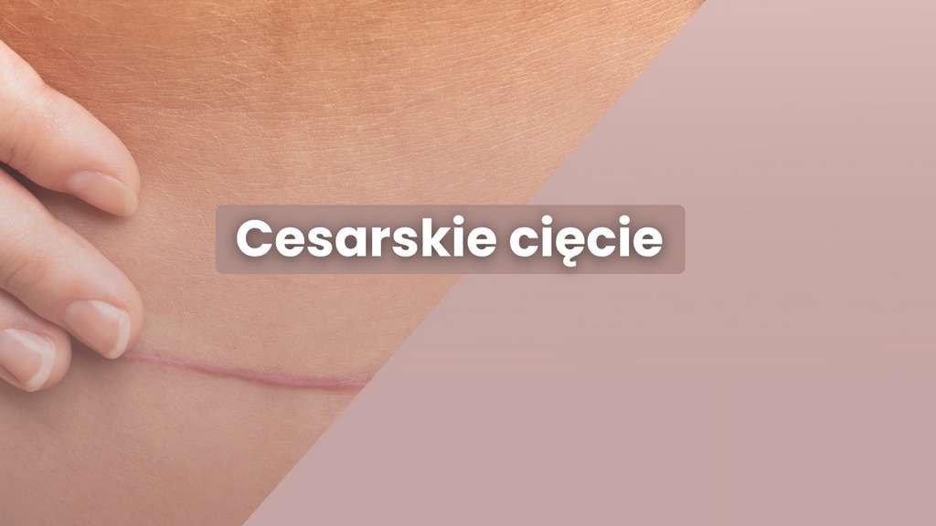 Cesarskie cięcie co musisz wiedzieć? Fizjoterapia uroginekologiczna Komorniki