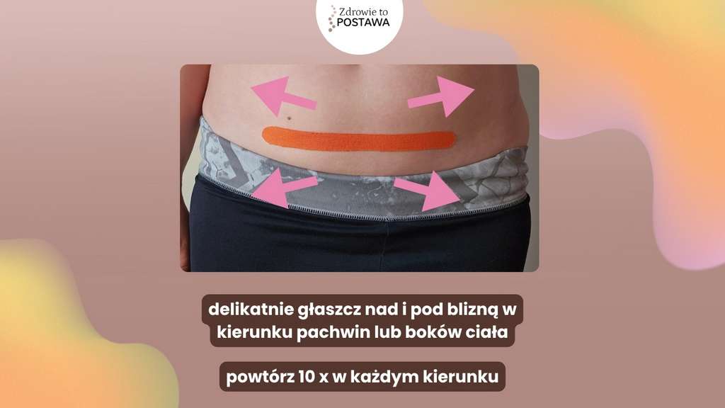 Masaż blizny fizjoterapia uroginekologiczna Komorniki Poznań